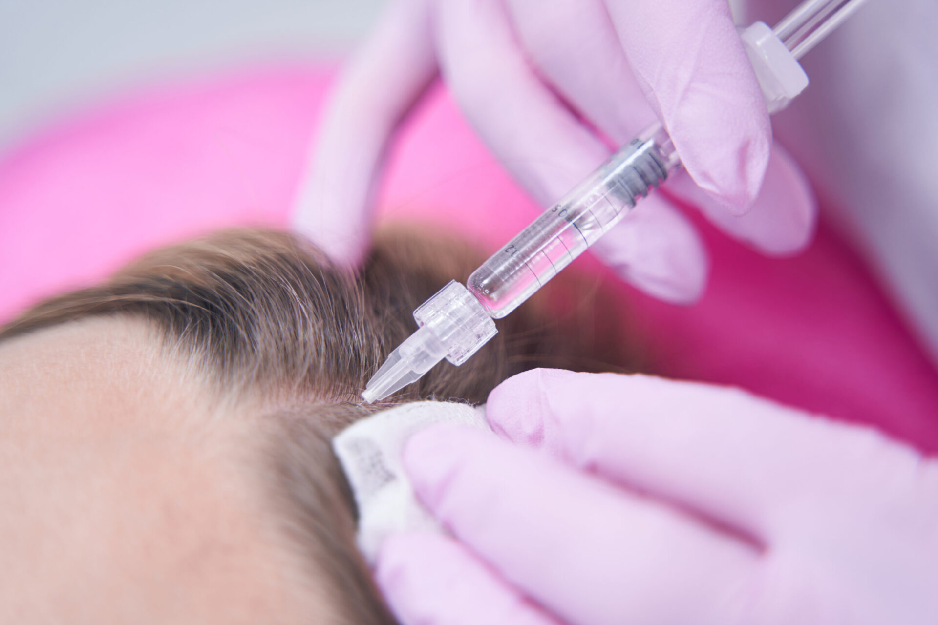 Closeup of doctor hands in nitrile gloves inserting syringe needle into scalp of woman
